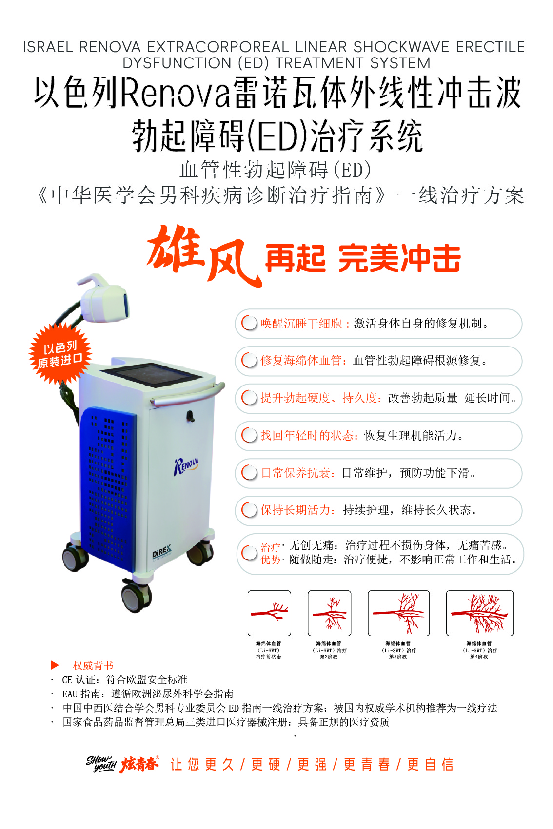 杭州炫青春男仕医学保养抗衰中心配备以色列原装进口Renova雷诺瓦体外线性冲击波男性机能障碍治疗系统